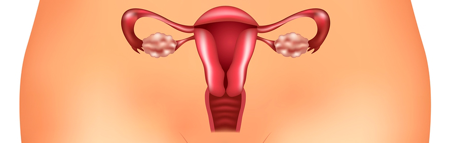 Polycystic-Ovarian-Syndrome