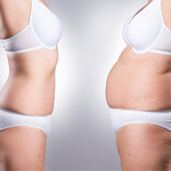 Long Term Weight Loss